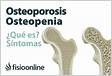 Osteopenia o que é, sintomas e tratamento